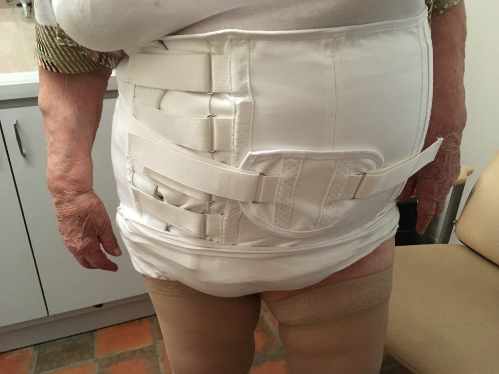 Bilateral shoulder brace Thermo-med 4803-5803 :  -  Orthopédiste-Orthésiste à Montargis. Orthèses de main thermoformables et  corsets sur-mesure.